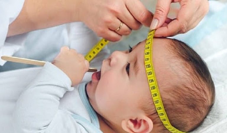 عدم رشد نرمال دور سر نوزاد دروس رزیدنت های مغز و اعصاب